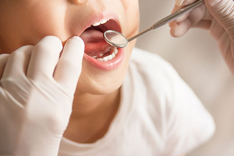 子どもの歯は虫歯にかかりやすい？