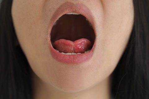 舌は、人が人らしく生きるために大切な器官です