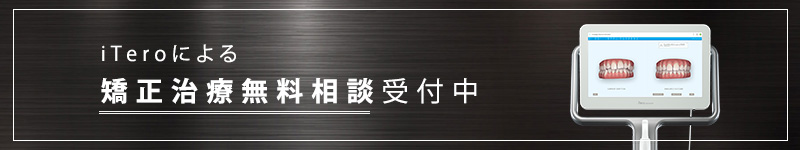 iTeroによる 矯正治療無料相談受付中